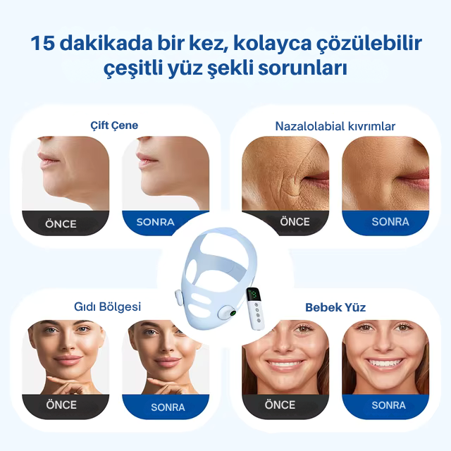 EMS Yüz inceltme şekillendirme V maskesi