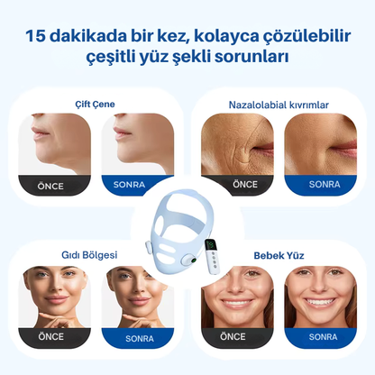 EMS Yüz inceltme şekillendirme V maskesi